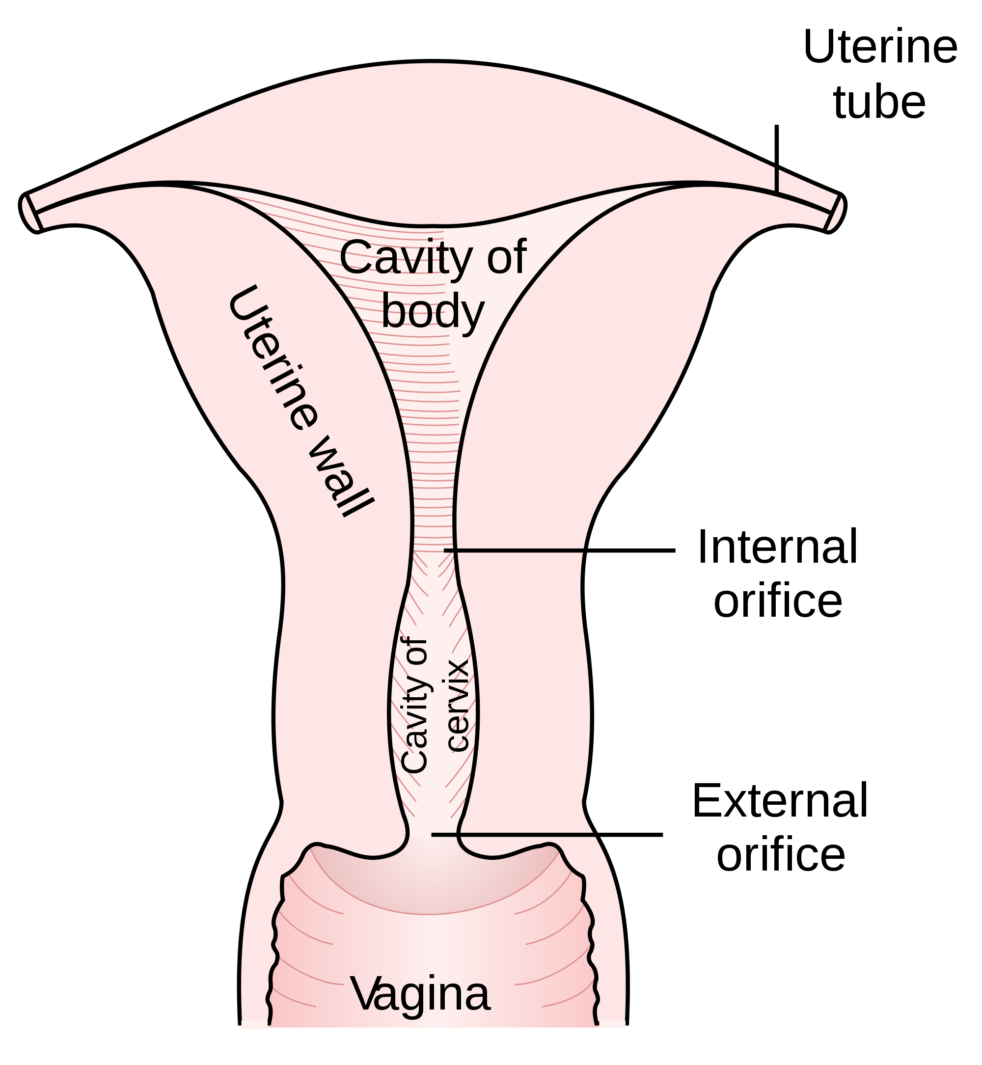Causes of Cervical Cancer