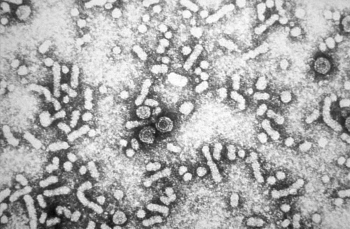Hepatitis B Virons