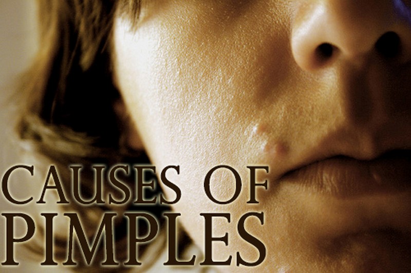 causes of pimples