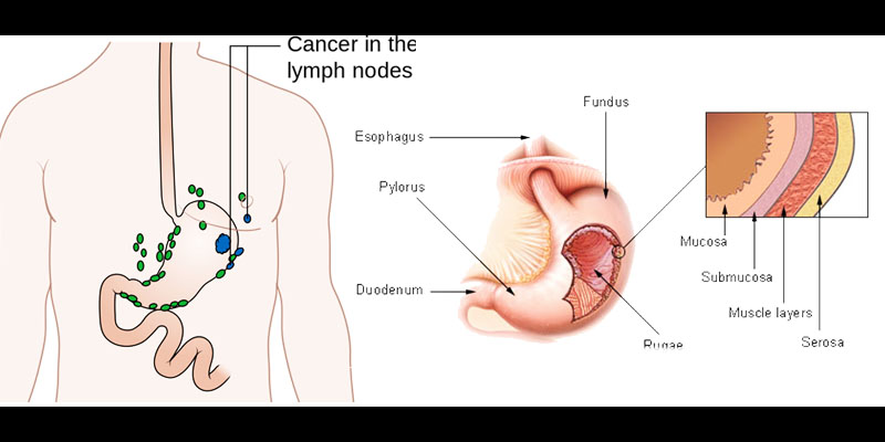 stomach parts indication